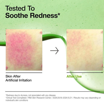 Anua Azelaic Acid 10 Hyaluron Redness Soothing Serum - 30ml