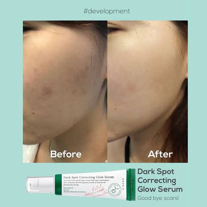 Axis -Y DARK SPOT CORRECTING GLOW SERUM
